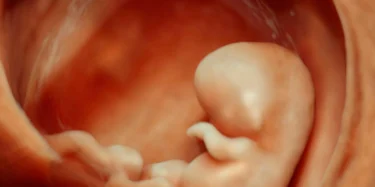 12 vikur gamalt fostur vigar 30 gr og er um 5 cm langt.